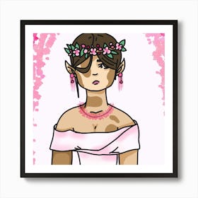 Beautiful vitiligo Art Print