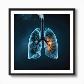 Lungs Stock Videos & Royalty-Free Footage 2 Art Print