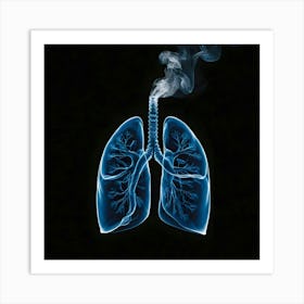 Lungs Stock Photos & Royalty-Free Footage Art Print