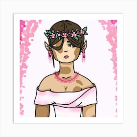 Beautiful vitiligo Art Print