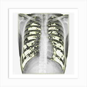 Skeleton Chest X Ray Easy Costume Art Print