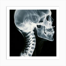 X-Ray Of A Skull Art Print