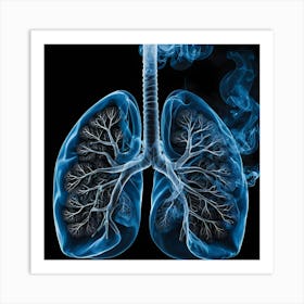 Lungs With Smoke 2 Art Print