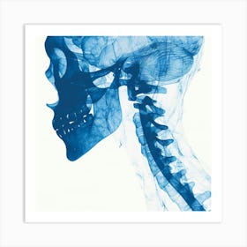 X - Ray Of A Head Art Print