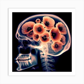 Brain With Flowers Art Print