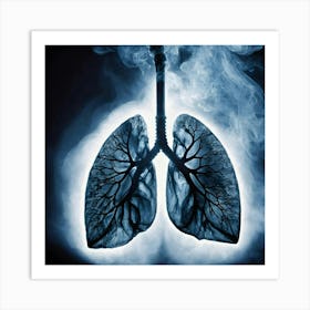 Lungs Stock Videos & Royalty-Free Footage 32 Art Print