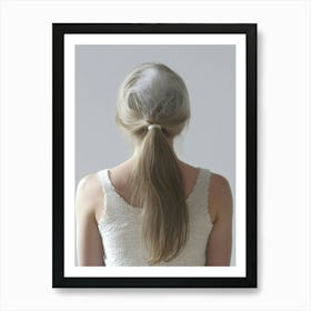 Back View Of A Woman With Hair Loss Art Print