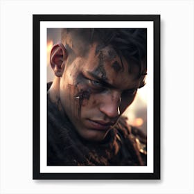 Young Man With Blood On His Face Art Print