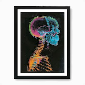 X - Ray Skull Art Print