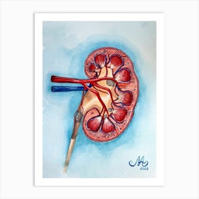 Kidney stones medicine Art Print