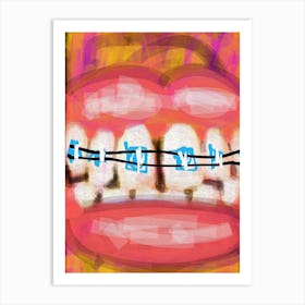 Braces Art Print