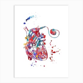 Heart Pacemaker Watercolor Art Print