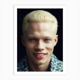 Portrait Of Albino Young Man Art Print