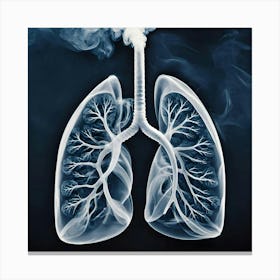 Lungs Stock Videos & Royalty-Free Footage 17 Canvas Print