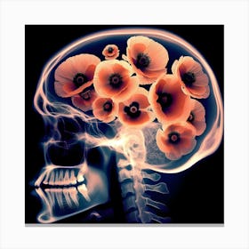 Brain With Flowers Canvas Print