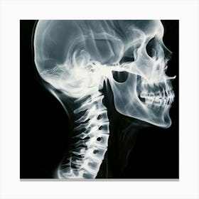 X-Ray Of A Skull Canvas Print