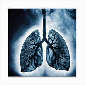 Lungs Stock Videos & Royalty-Free Footage 32 Canvas Print