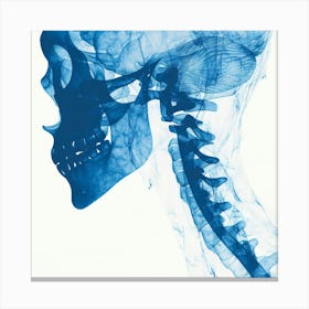 X - Ray Of A Head Canvas Print