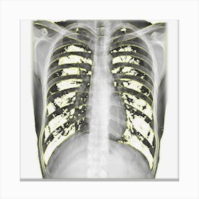 Skeleton Chest X Ray Easy Costume Canvas Print