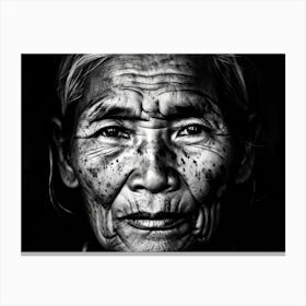 Portrait Of A Seasoned Older Face Cracks Spreading Spots Peppered Like Freckles Chips In The Skin 1 Canvas Print