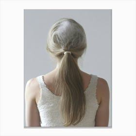 Back View Of A Woman With Hair Loss Canvas Print