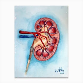 Kidney stones medicine Canvas Print